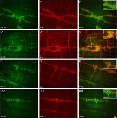 Antioxidant Effects of the Quercetin in the Jejunal Myenteric Innervation of Diabetic Rats